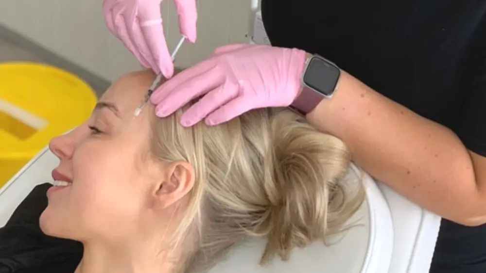 Anti-Wrinkle Injections before and after result 4