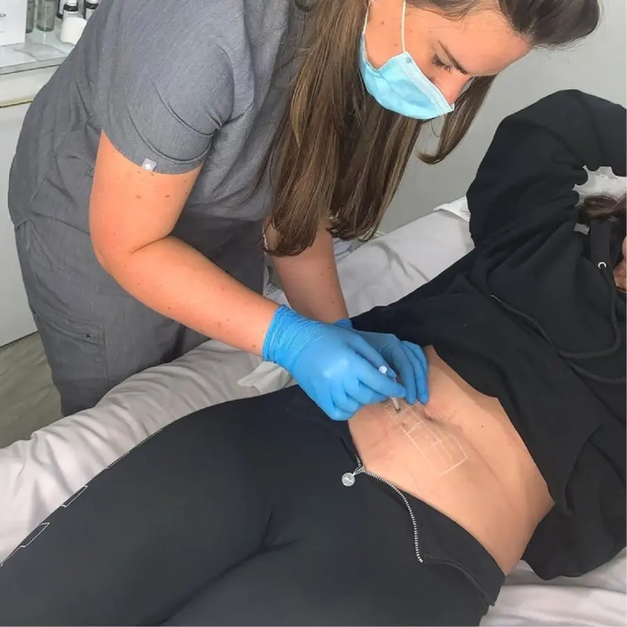 Aqualyx Fat Dissolving Injections