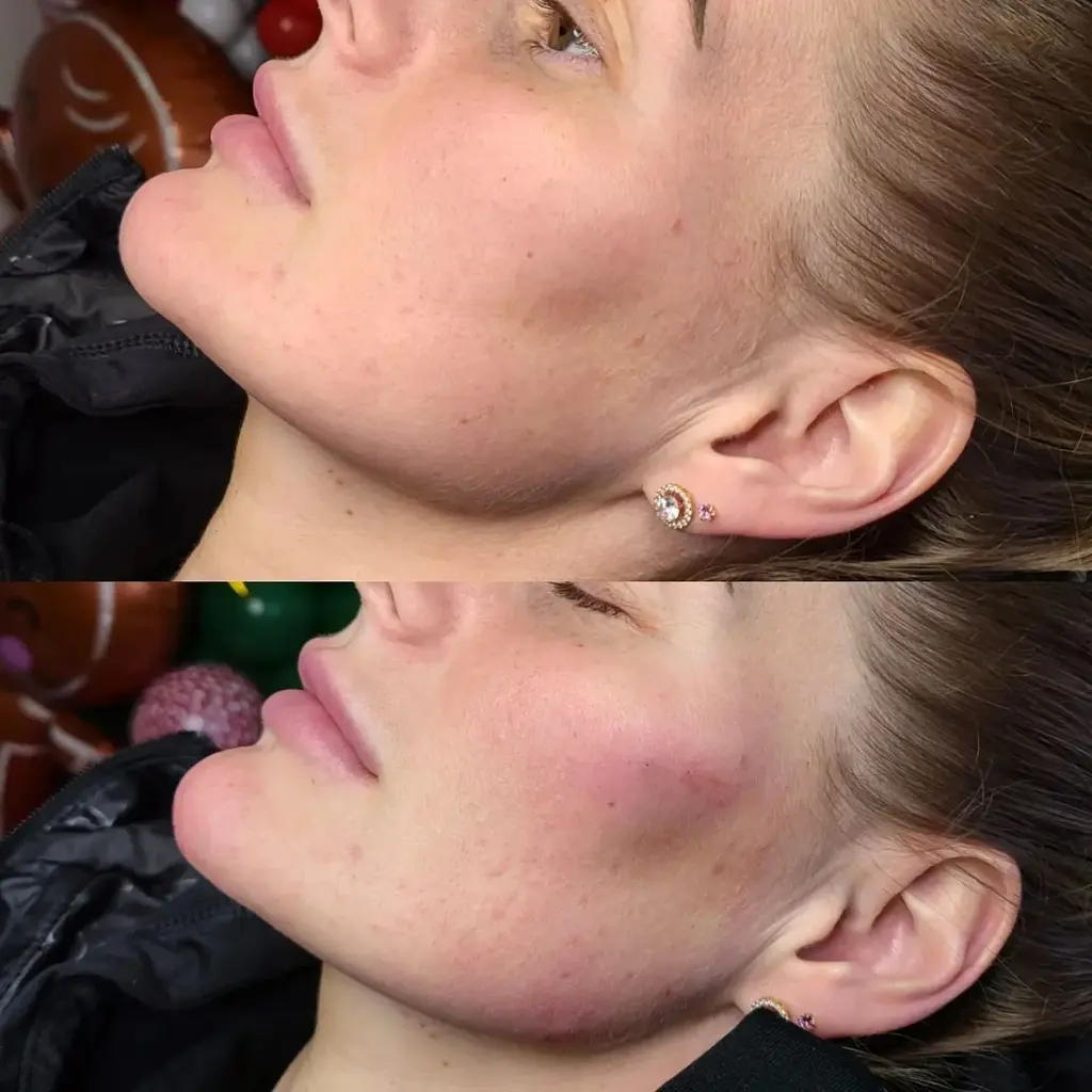 Contour Packages before and after result 1