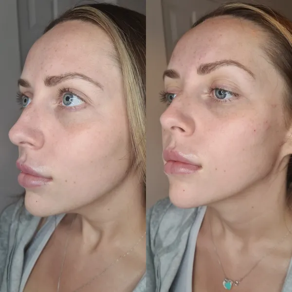 Contour Packages before and after result 3